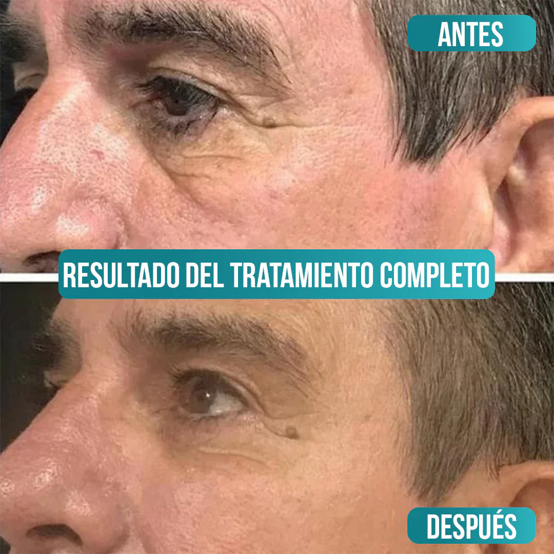 Crema Antiedad para Hombres - BioquaMen [Vitamina C + ácido Hialurônico]